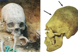 Sự thật chấn động 51 hộp sọ bị kéo dài ở Hungary