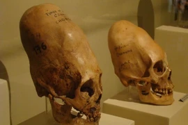 Bí ẩn những hộp sọ lạ thường