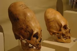 Bí ẩn những hộp sọ lạ thường