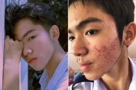 Chàng trai 10X "lột xác" ngoạn mục thành "hotboy cực phẩm" 