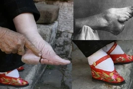 Hoảng hồn tục bó chân gót sen đau đớn của phụ nữ Trung Quốc