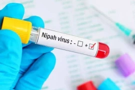 Virus Nipah bùng phát, tỷ lệ tử vong tới 75%
