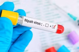 Virus Nipah bùng phát, tỷ lệ tử vong tới 75%
