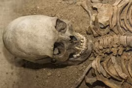 Giải mã tập tục khiến hộp sọ dài như quả trứng của người xưa