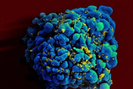 Phát hiện người thứ hai tự khỏi HIV