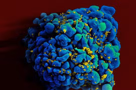 Phát hiện người thứ hai tự khỏi HIV