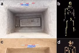 Phát hiện bộ xương 2.500 năm tuổi cụt chân, sự thật là gì 