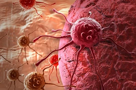 Thói quen sinh hoạt hàng ngày khiến nam giới dễ mắc ung thư hơn phụ nữ