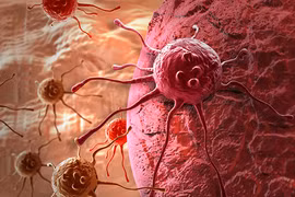 Thói quen sinh hoạt hàng ngày khiến nam giới dễ mắc ung thư hơn phụ nữ