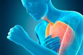 Những dấu hiệu buổi sáng cảnh báo ung thư phổi