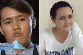 Cô gái Sài Gòn mặt lưỡi liềm xấu xí giờ ra sao?