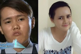 Cô gái Sài Gòn mặt lưỡi liềm xấu xí giờ ra sao?