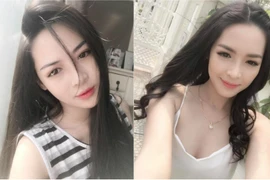 Hot girl Nam Định ước tính "xây lại mặt" hết 1,5 tỷ