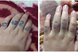 Thiếu nữ xăm hình từ lớp 8 và vết sẹo đi theo cả cuộc đời