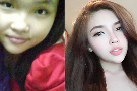 Cô gái làm hàng chục tiểu phẫu thẩm mỹ trong suốt 4 năm