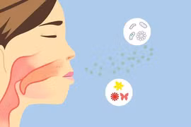 Nhận biết viêm nắp thanh quản cấp cực nguy kịch trong thời gian ngắn