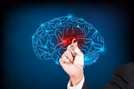 Những tín hiệu cảnh báo xuất huyết não không nên bỏ qua