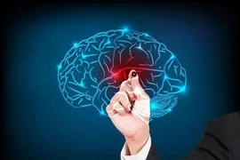 Những tín hiệu cảnh báo xuất huyết não không nên bỏ qua