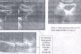 Suýt mất mạng vì những kiểu chữa bệnh quái đản