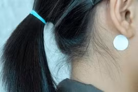 Sai lầm tai hại khi dùng miếng dán chống say xe