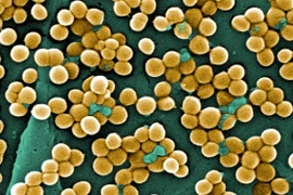 Tụ cầu vàng có thể gây tử vong: Phòng tránh thế nào?