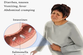 Triệu chứng nhiễm khuẩn Salmonella dễ nhầm lẫn