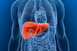 Nhận biết bệnh gan nhiễm mỡ tiến triển nặng qua dáng đi