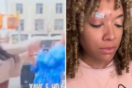 Đang phỏng vấn, nữ phóng viên bị tấn công dã man giữa phố