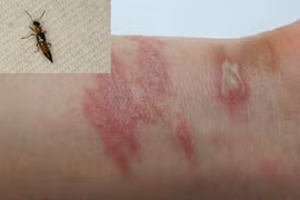 Cách đuổi kiến ba khoang khỏi nhà hiệu quả, không độc hại