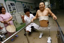 'Dị nhân nửa người' Peng Shuilin đã tạo nên điều kỳ diệu như nào?