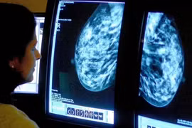 Thuốc tiềm năng trị 70 loại ung thư hoạt động thế nào?