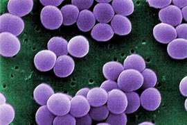 Nhiễm khuẩn tụ cầu vàng nguy hiểm ra sao?