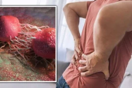 Những dấu hiệu của ung thư tuyến tiền liệt