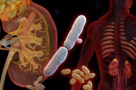 Bệnh nhiễm trùng tiết niệu nguy hiểm ra sao?