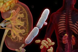 Bệnh nhiễm trùng tiết niệu nguy hiểm ra sao?