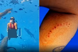 Hãi hùng khoảnh khắc người phụ nữ bị cá mập cắn khi đang lặn