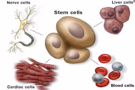 Điều trị bằng liệu pháp tế bào gốc có ưu điểm gì?