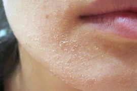 Không muốn bị đột quỵ khi đi tắm mùa đông, cần chú ý những gì?