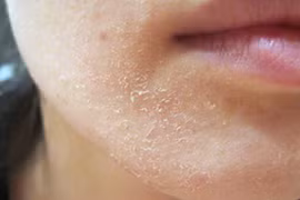 Không muốn bị đột quỵ khi đi tắm mùa đông, cần chú ý những gì?