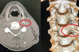 Uống "nước thần" của bà mo, bệnh nhân nhập viện khẩn cấp