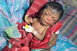 Choáng váng em bé chào đời trong hình hài... ông lão 80