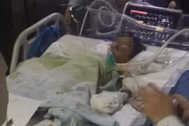 Đang nhún trên bạt lò xo, bé gái 8 tuổi gặp họa trong tích tắc