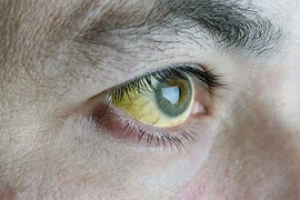 5 tín hiệu ít ai ngờ báo hiệu bạn cần đến bệnh viện ngay