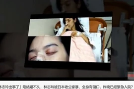 Lâm Chí Linh bị bạo hành sau 4 tháng kết hôn?