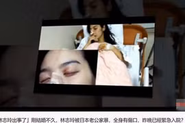 Lâm Chí Linh bị bạo hành sau 4 tháng kết hôn?