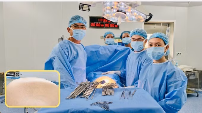 Các bác sĩ đang phẫu thuật cho bệnh nhân/Ảnh BVCC