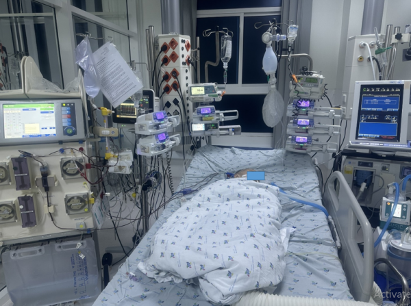 Bé trai 24 tháng tuổi, chẩn đoán bệnh tay chân miệng độ 4, được điều trị tích cực đặt nội khí quản giúp thở, truyền IVIG, an thần phenobarbital, midazolam, fentanyl, lọc máu liên tục. Ảnh BV