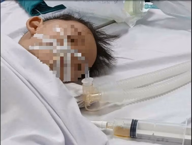 Hình ảnh bé trai 18 tháng tuổi bị đuối nước được các bác sĩ cứu sống. Ảnh: BVCC.