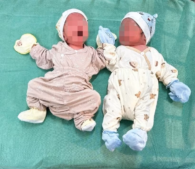 Sản phụ hạ sinh 2 bé gái đều nặng 2,8 kg. (Ảnh SKĐS)