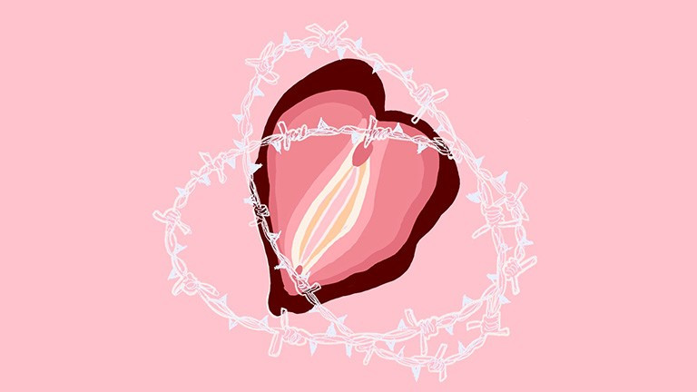 Hội chứng co thắt âm đạo (Vaginismus) là một dạng rối loạn chức năng tình dục xảy ra ở bộ phận âm đạo/Ảnh minh hoạ/Nguồn Internet